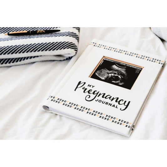 Pearhead - Pregnancy Journal - Black White & Gold