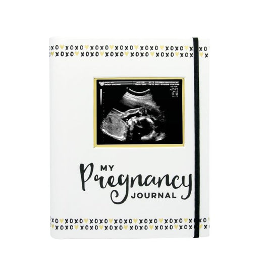 Pearhead - Pregnancy Journal - Black White & Gold