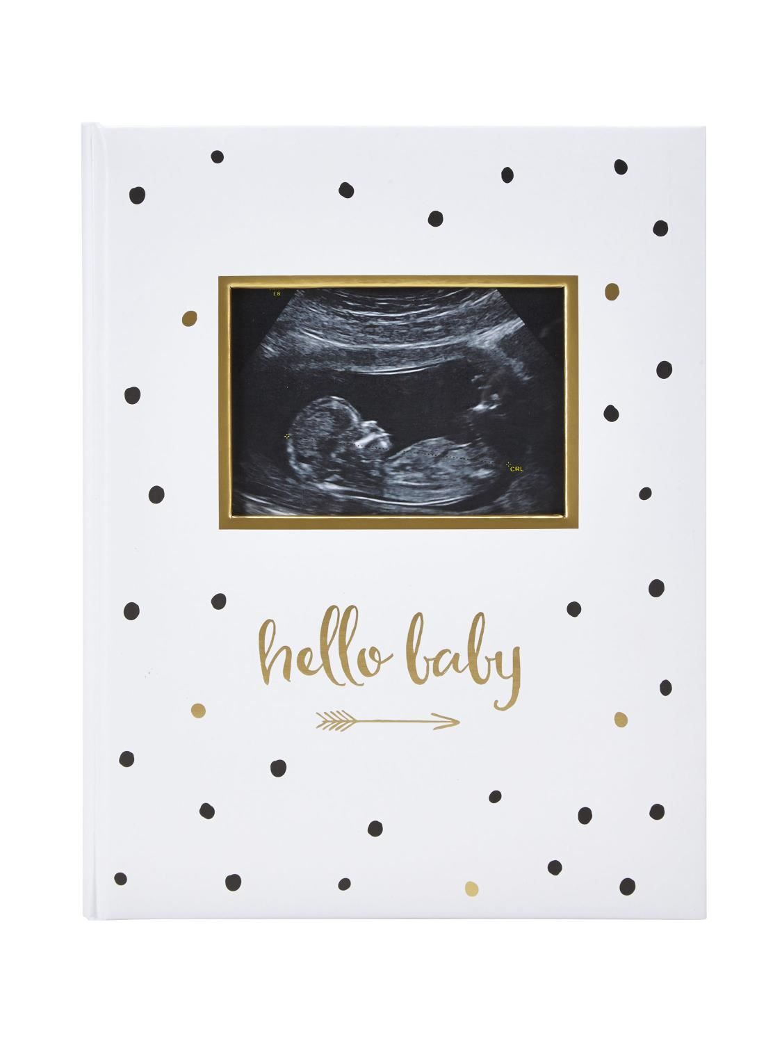 Pearhead - Baby Book - Black And Gold
