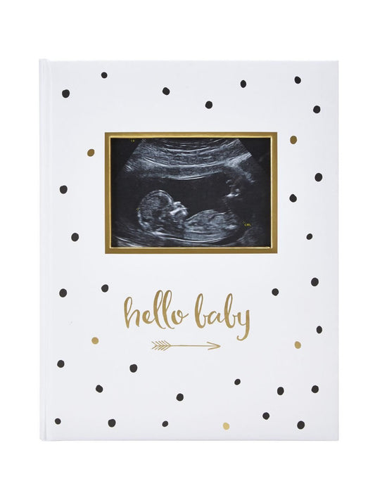 Pearhead - Baby Book - Black And Gold