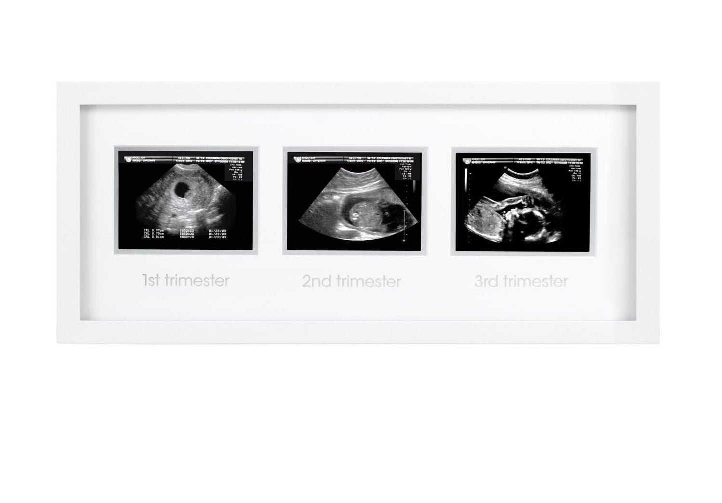 Pearhead - Triple Sonogram Frame